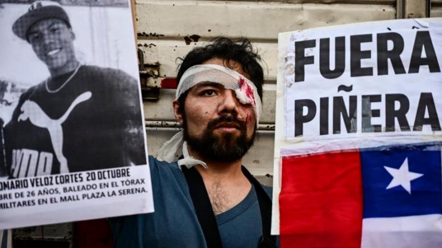 Conmoción en Chile por suicidio de víctima de trauma ocular Conmoción en Chile por suicidio de víctima de trauma ocular