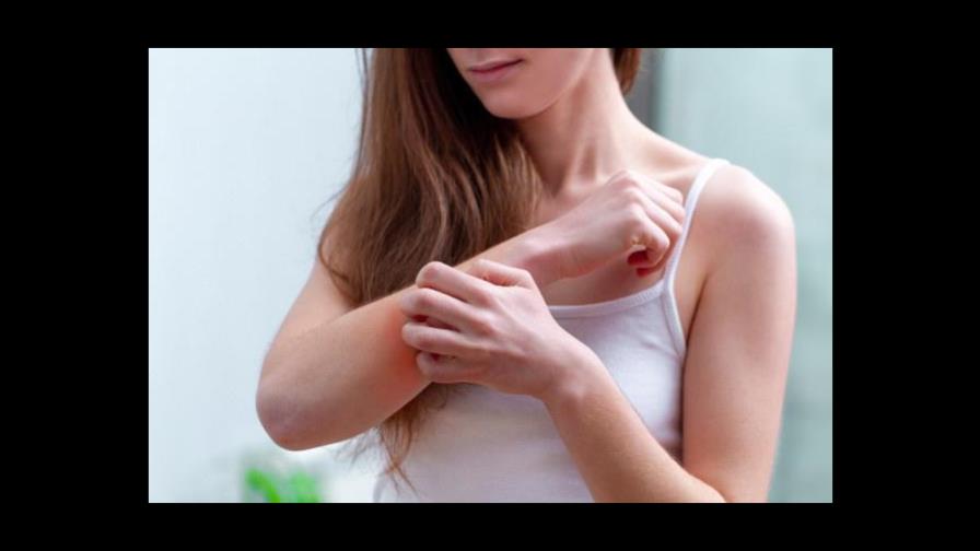 Psoriasis, la enfermedad difícil de tratar que padece Kim Kardashian