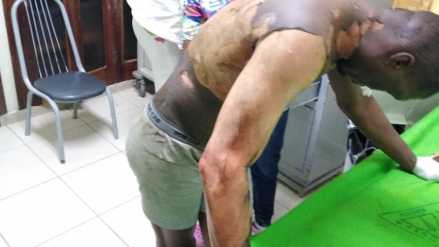 Mujer prende fuego a su marido mientras estaba acostado