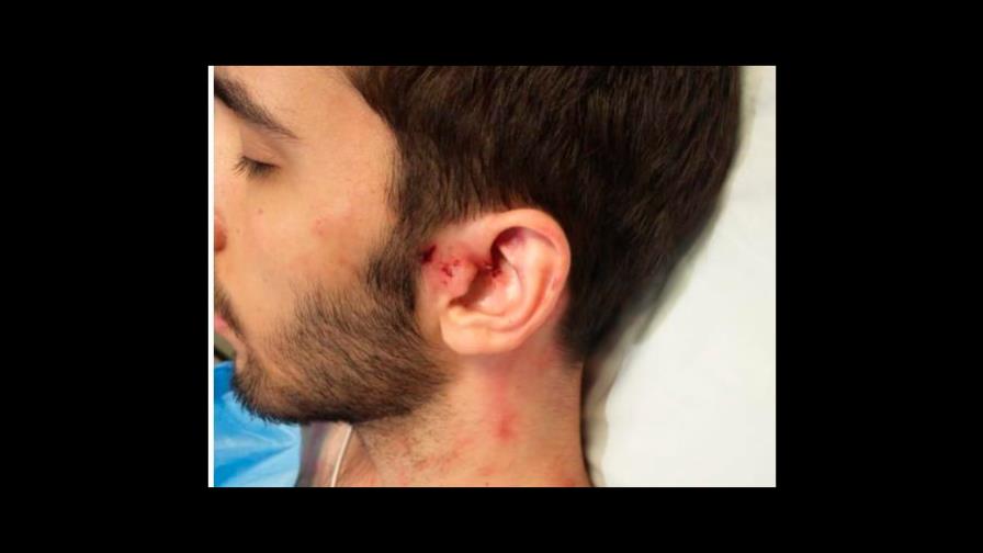 Madre de uno de los jóvenes raptados y golpeados: “Era a matarlos que iban”