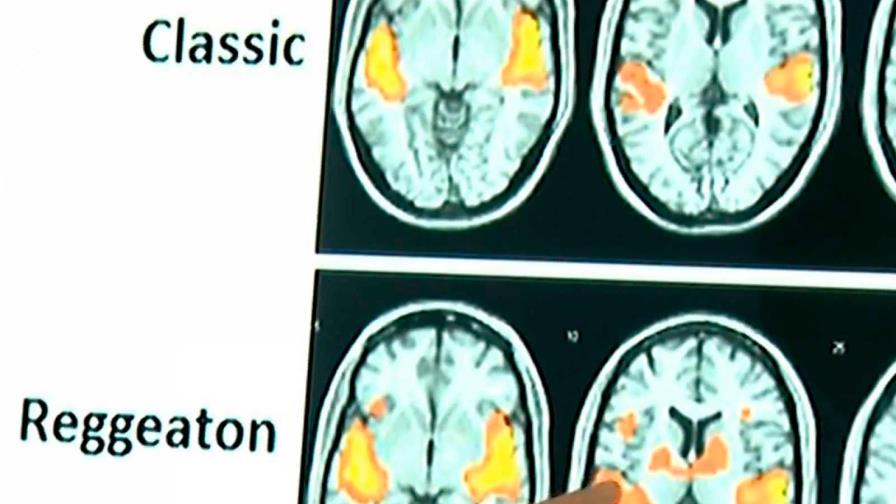 El reguetón provoca mayor actividad cerebral que escuchar clásica o folclore