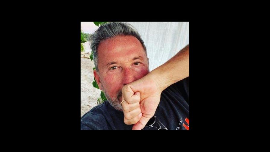 Ricardo Montaner confiesa estar devastado por muerte de primo por coronavirus Ricardo Montaner confiesa estar devastado por muerte de primo por coronavirus