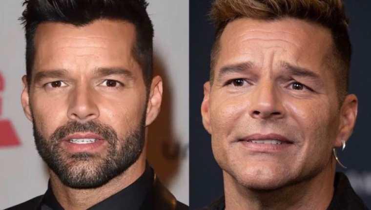 ¿Retoque estético? Ricky Martin causa asombro por cambios en su rostro