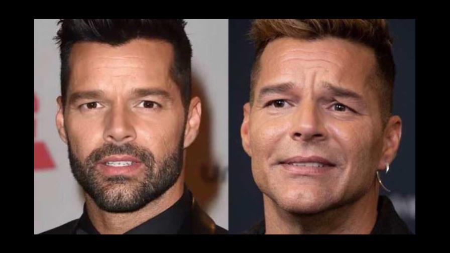 ¿Retoque estético? Ricky Martin causa asombro por cambios en su rostro