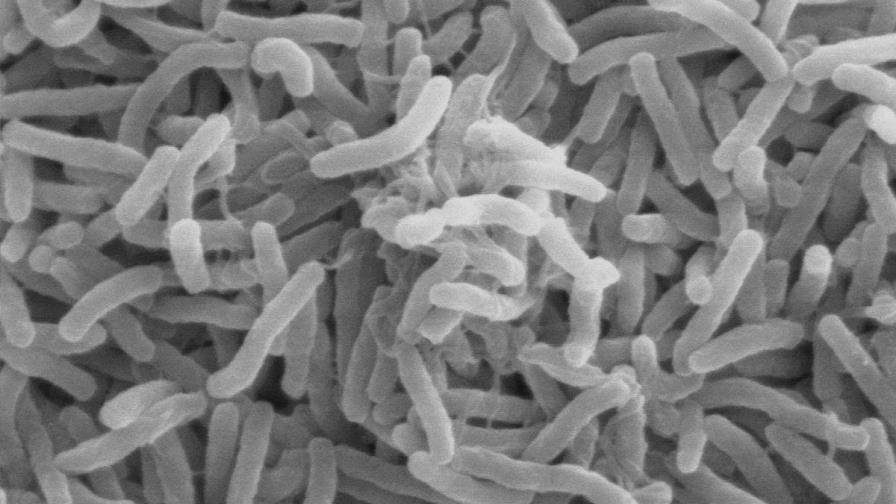 Nigeria intenta combatir con vacunación un grave brote de cólera en el país