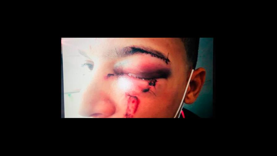 Joven requiere ayuda para operación luego de agresión policial
