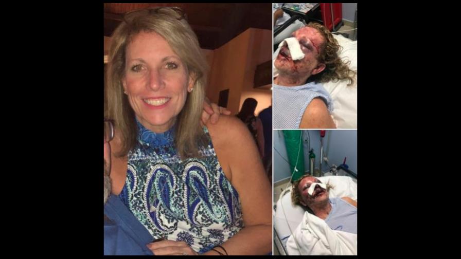 Turista dice que fue casi asesinada por empleado de resort en Punta Cana Turista dice que fue casi asesinada por empleado de resort en Punta Cana