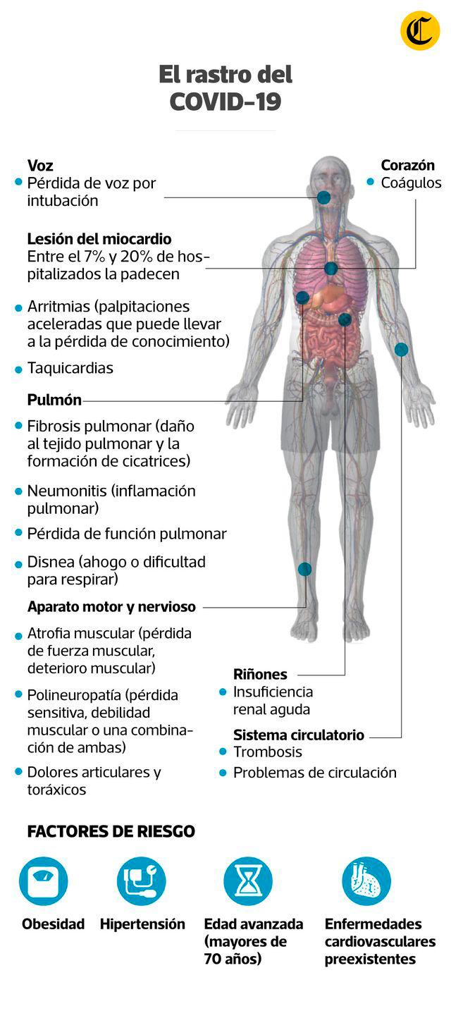 Infografía
