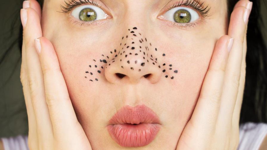 ¡No más puntos negros! Deshazte de ellos con estas mascarillas caseras