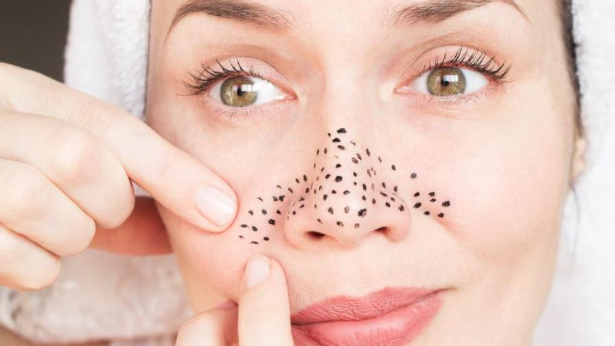 Sigue estos consejos para evitar tener puntos negros