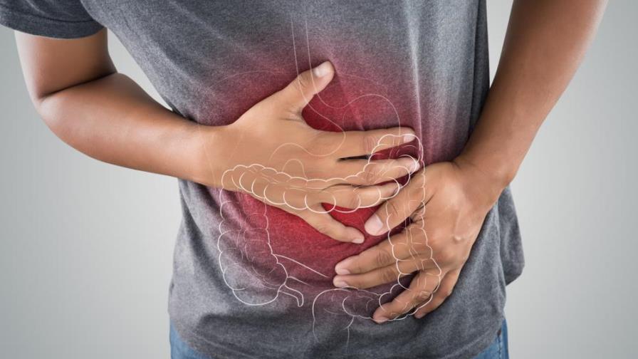 Cuáles son los factores de riesgo del cáncer de colon y sus características Cuáles son los factores de riesgo del cáncer de colon y sus características
