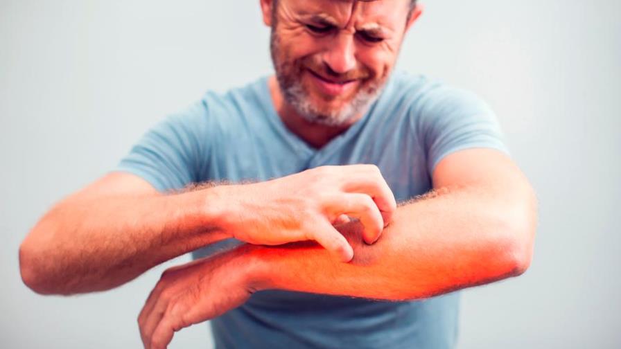 Estas señales en tu piel podrían estar indicándote una enfermedad Estas señales en tu piel podrían estar indicándote una enfermedad