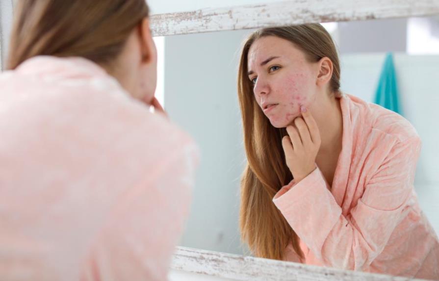 La dermatitis atópica sí es controlable en niños y adolescentes 