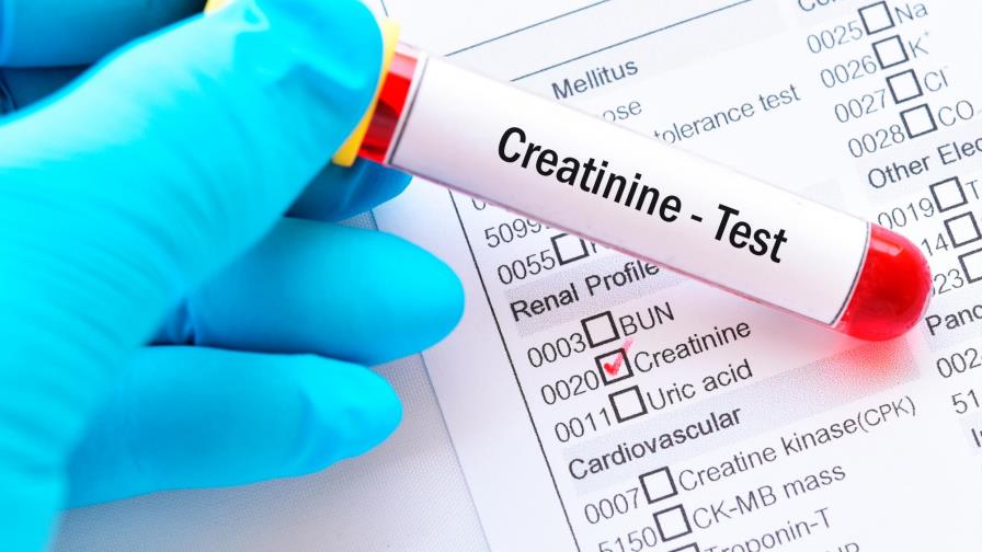 ¿Qué debo hacer si la creatinina está alta?
