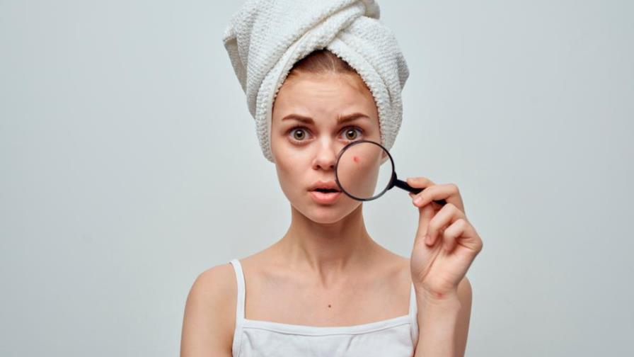 Estos errores habituales pueden provocar acné