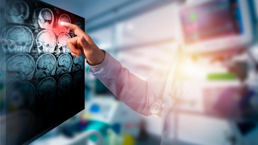 ¿Sabrías detectar un derrame cerebral?