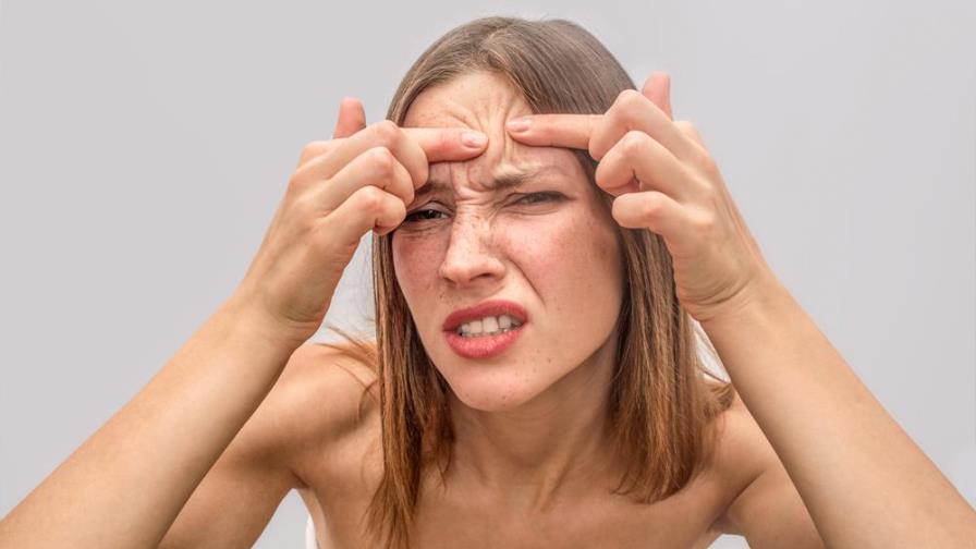 Así puedes quitar un grano de tu cara de manera rápida y sin causar más problemas