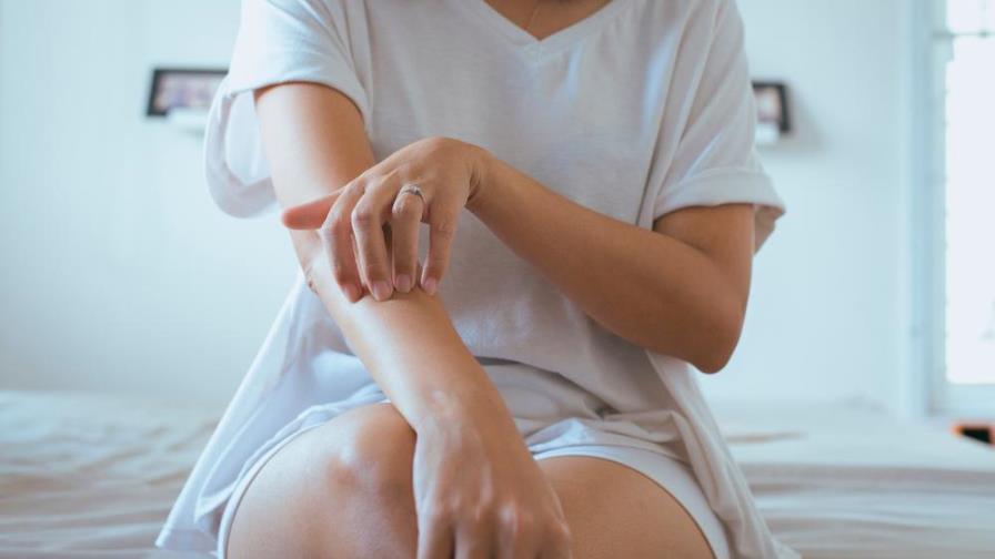 Así afecta la psoriasis a la vida sexual