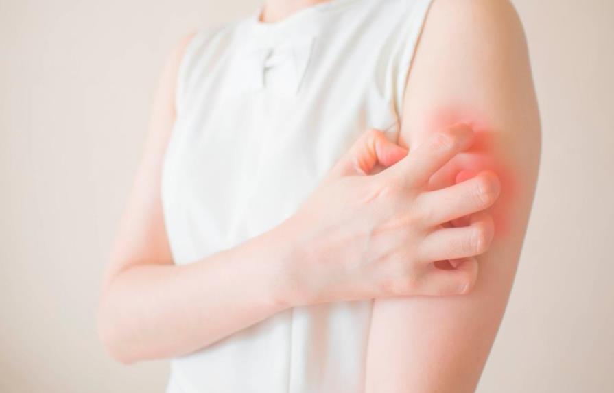 ¿Qué es la dermatitis y por qué ocurre?