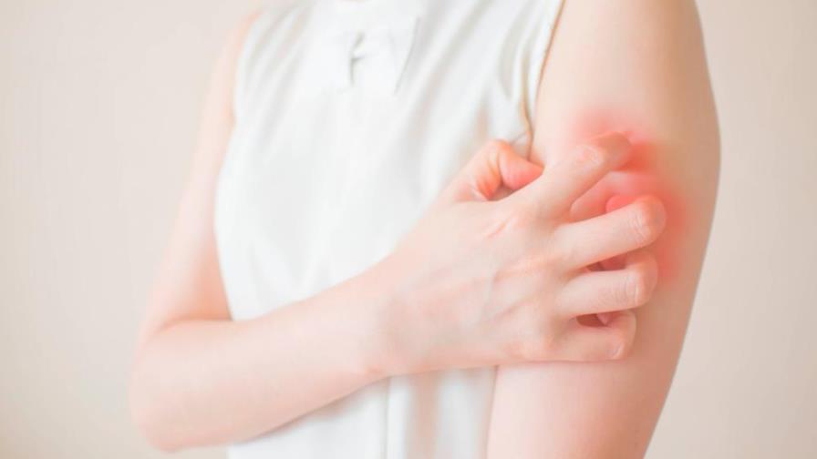 ¿Qué es la dermatitis y por qué ocurre?