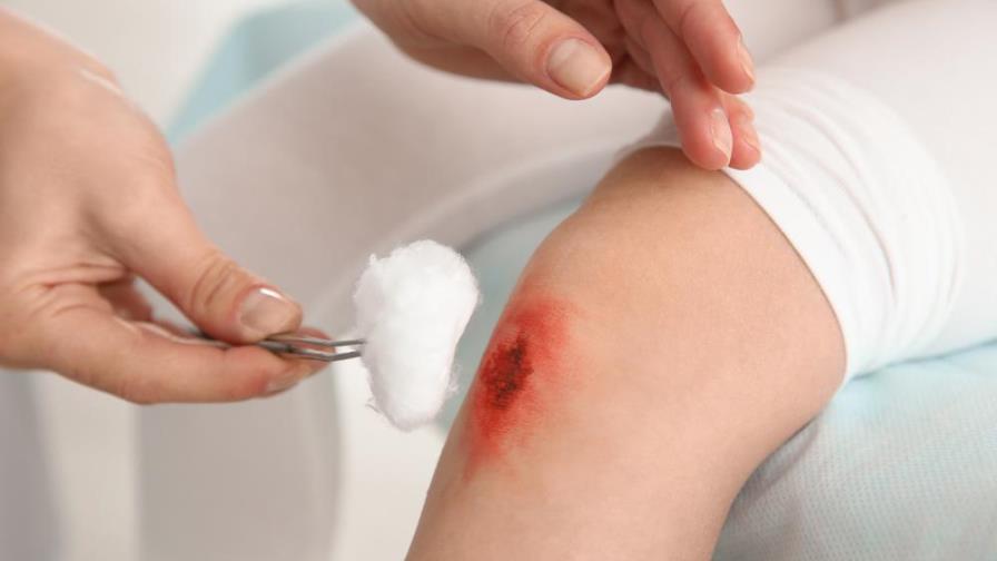 ¡Sigue estos cuidados para evitar que una herida se infecte!