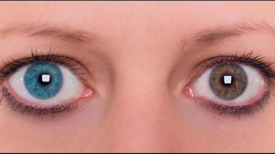 Por estas razones algunas personas tienen los ojos de diferentes colores Por estas razones algunas personas tienen los ojos de diferentes colores