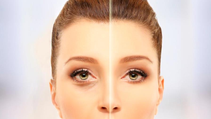 ¿Cómo tratar las ojeras y lograr que desaparezcan? ¿Cómo tratar las ojeras y lograr que desaparezcan?