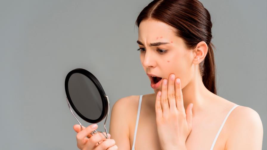 ¿Qué usan las famosas contra el acné?