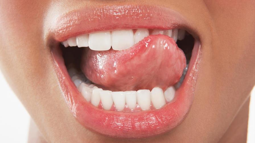 Tres opciones prácticas para lucir dientes más blancos
