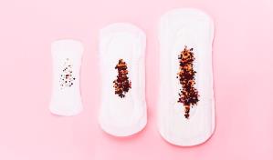 ¿Qué dice tu secreción vaginal según su color?