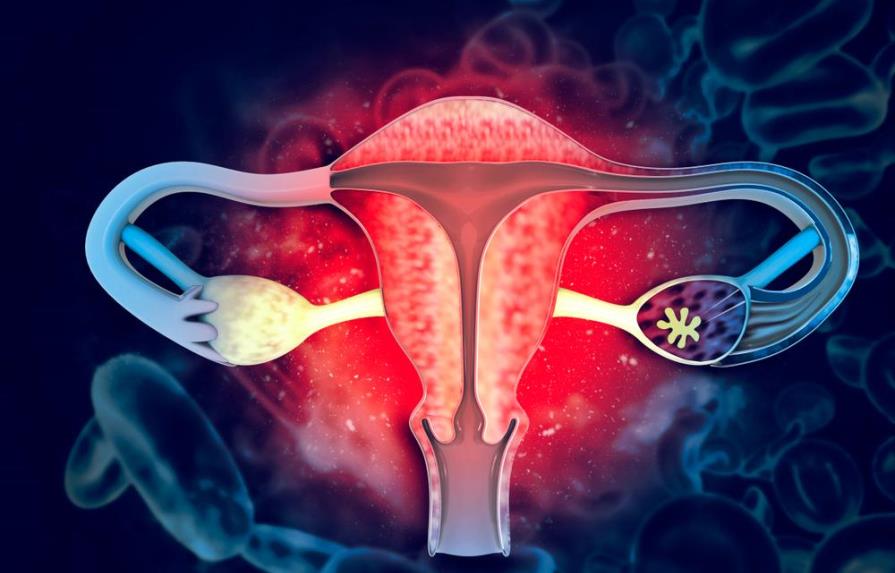 Fibromas Uterinos Causas S Ntomas Y Tratamiento Diario Libre