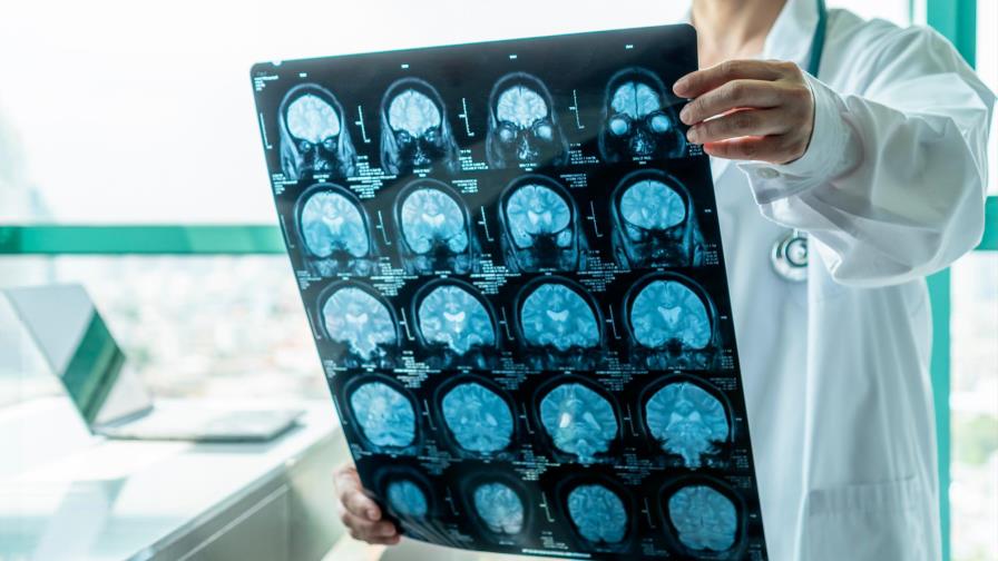 Estudian casos de encefalitis en el sur de Alemania