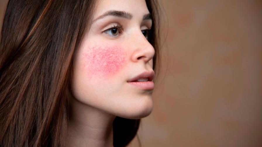 ¿Piel rosácea? Evita estos cosméticos