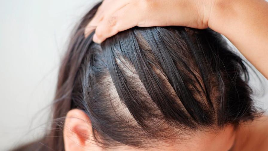 Así puedes exfoliar tu cuero cabelludo