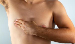 Cuáles son los síntomas del cáncer de mama masculino