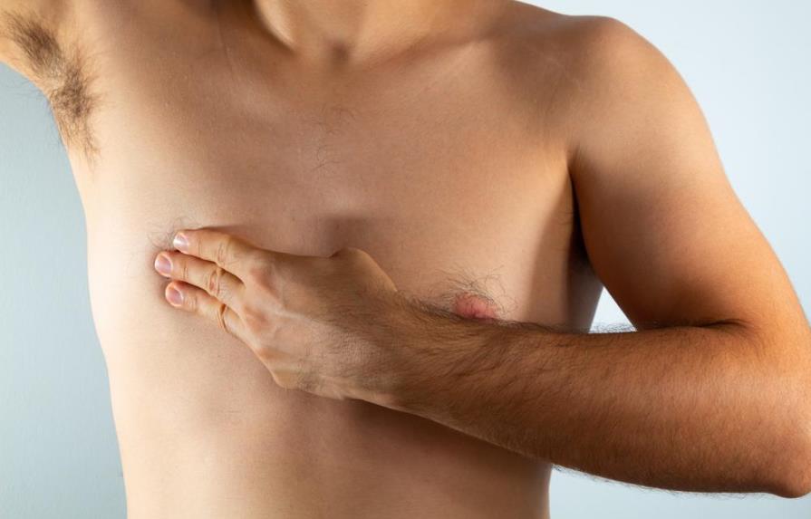 Cuáles son los síntomas del cáncer de mama masculino