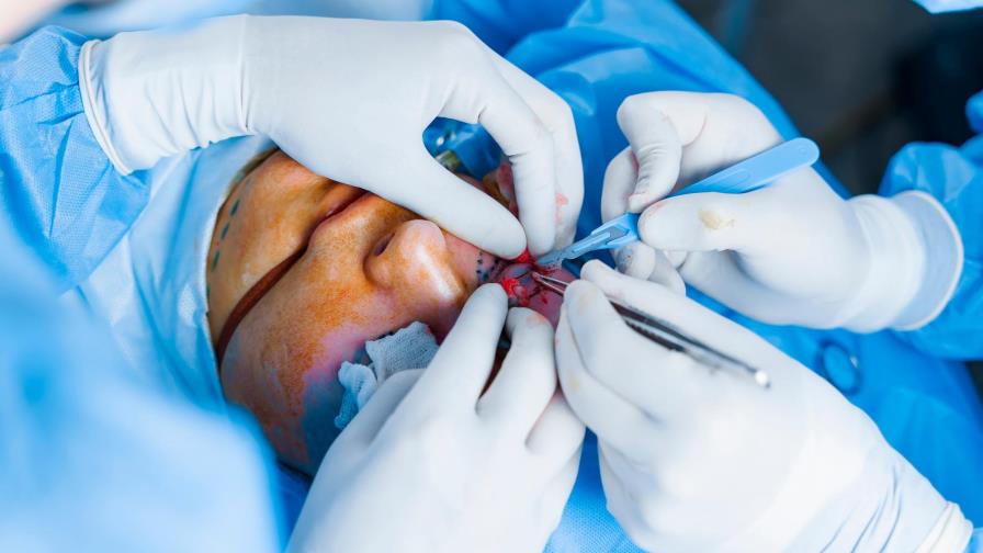 Estas estrellas de Hollywood fueron víctimas de sus propias cirugías