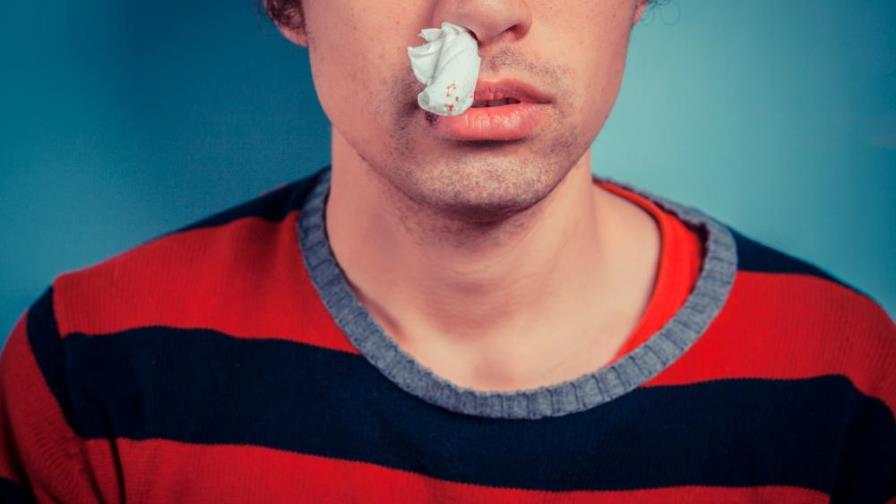 Por qué puede sangrar la nariz