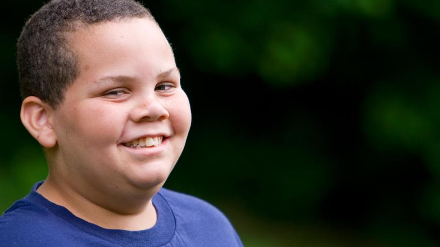 Sobrepeso y obesidad infantil Sobrepeso y obesidad infantil