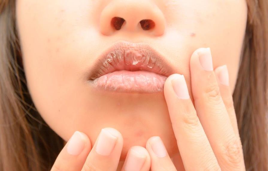 ¿Cómo hidratar los labios y evitar su descamación? 