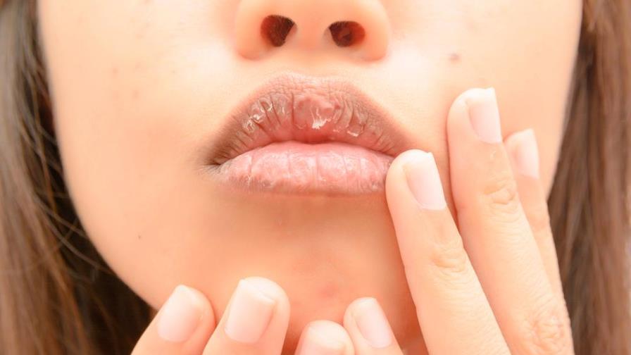 ¿Cómo hidratar los labios y evitar su descamación? 