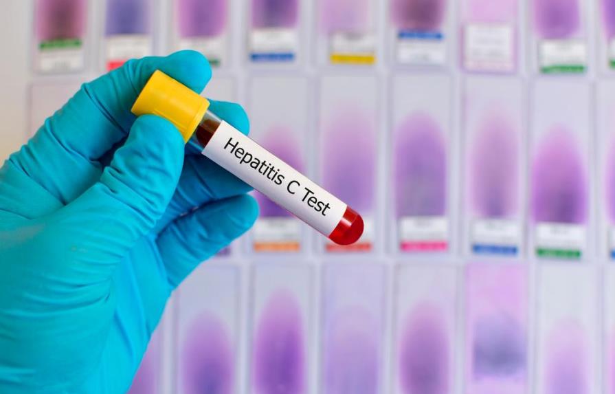 Los enfermos renales son más susceptibles de contraer la Hepatitis C