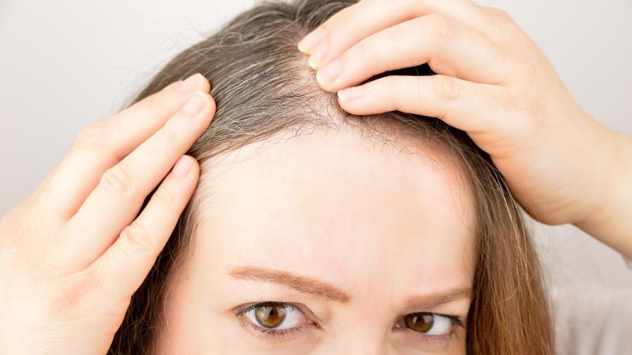 Deshazte de las canas en casa sin necesidad de usar tintes