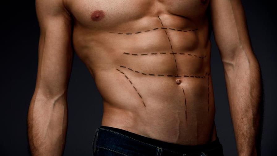 ¿Qué cirugías estéticas se están realizando los hombres?