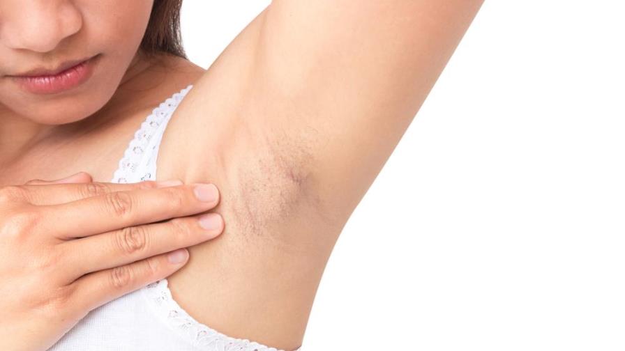 Estos hábitos hacen que se manchen tus axilas