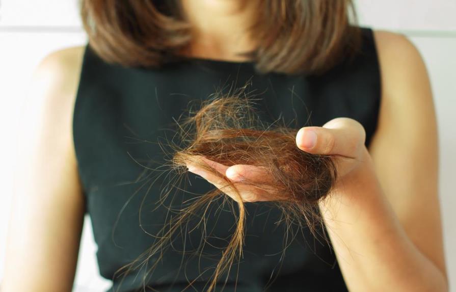 Alopecia femenina o pérdida de cabello: un problema que preocupa a las mujeres