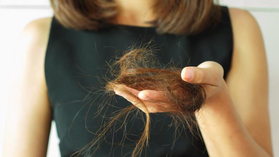 Alopecia femenina o pérdida de cabello: un problema que preocupa a las mujeres