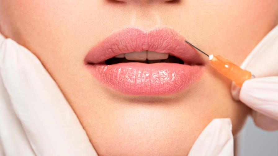 Desmonta los mitos sobre el bótox