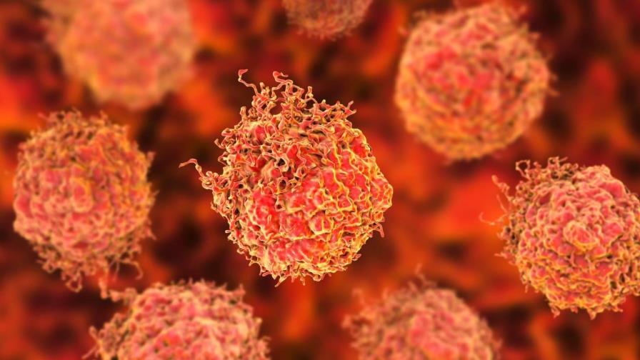 Identifican genes que permiten a células del cáncer eludir el sistema inmune Identifican genes que permiten a células del cáncer eludir el sistema inmune