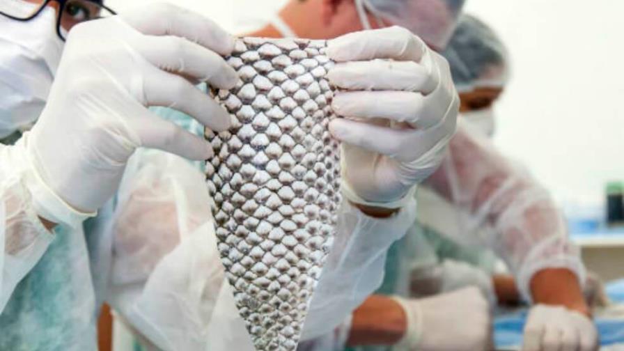 Reconstruyen una vagina con piel de pescado en Colombia 